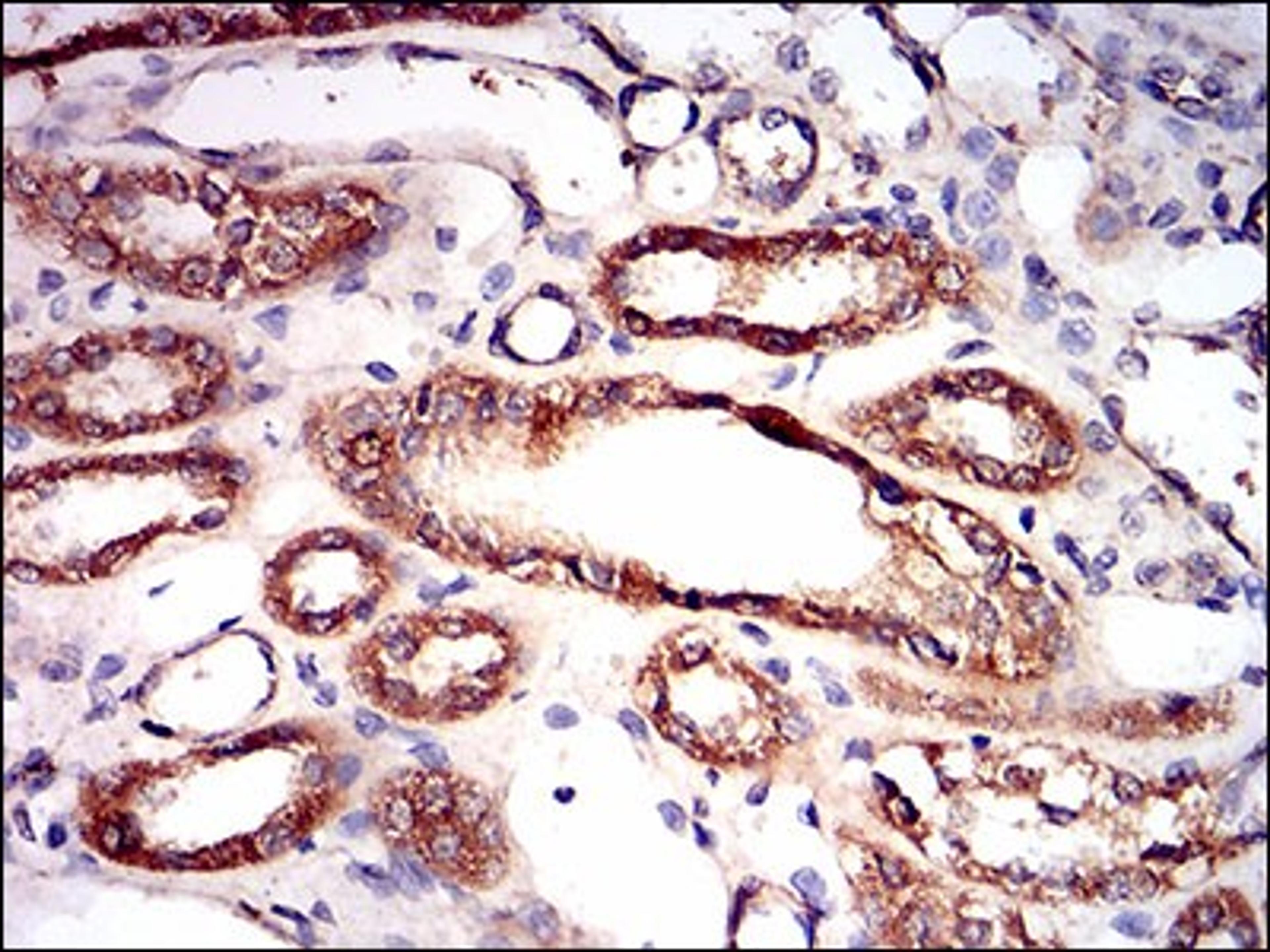 Immunohistochemistry: AMPK gamma 1 Antibody (7H3E9) [NBP2-37285] - Immunohistochemical analysis of paraffin-embedded kidney tissues using PRKAG1 mouse mAb with DAB staining.