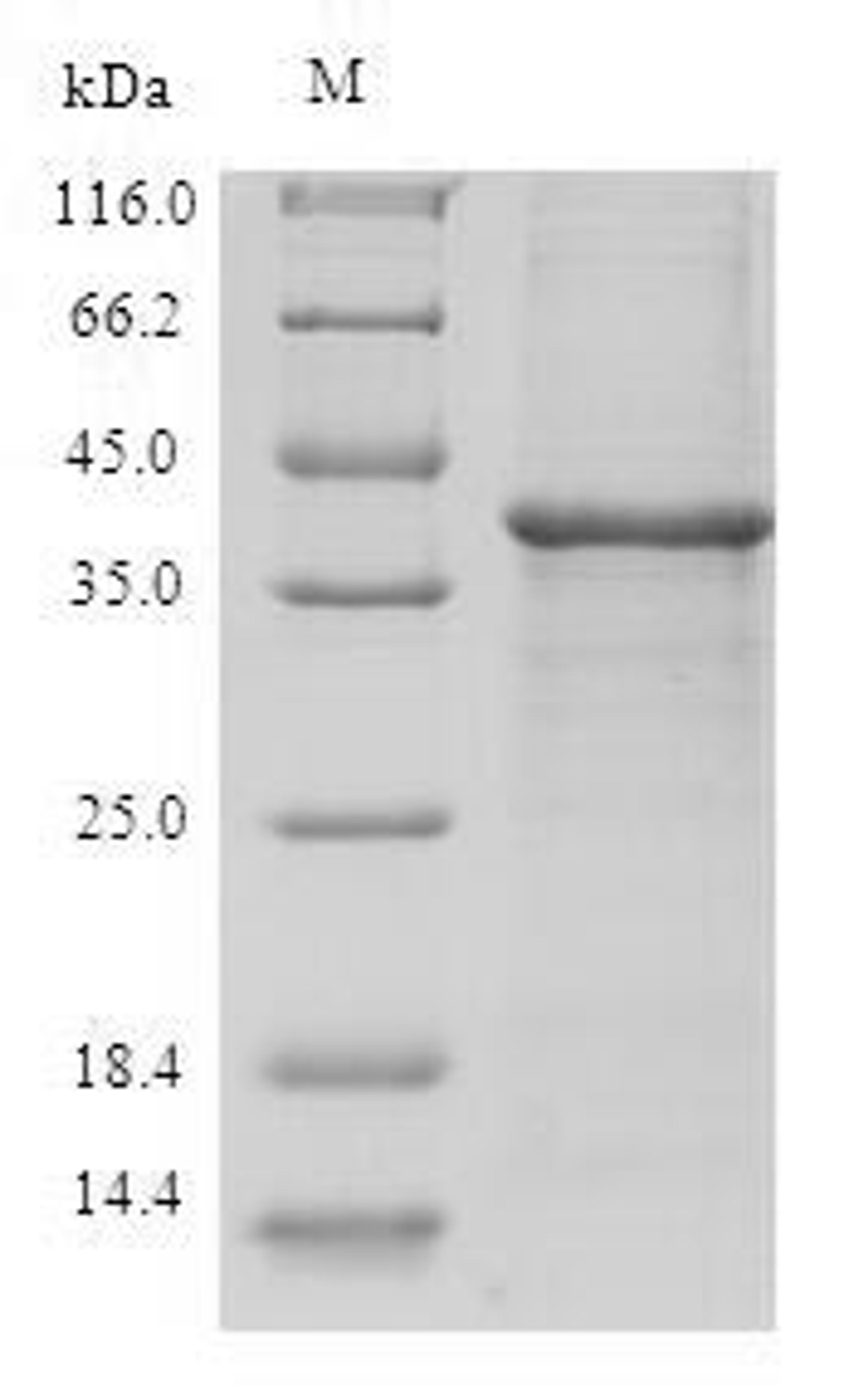 (Tris-Glycine gel) Discontinuous SDS-PAGE (reduced) with 5% enrichment gel and 15% separation gel.