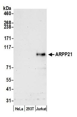 Detection of human ARPP21 by WB.