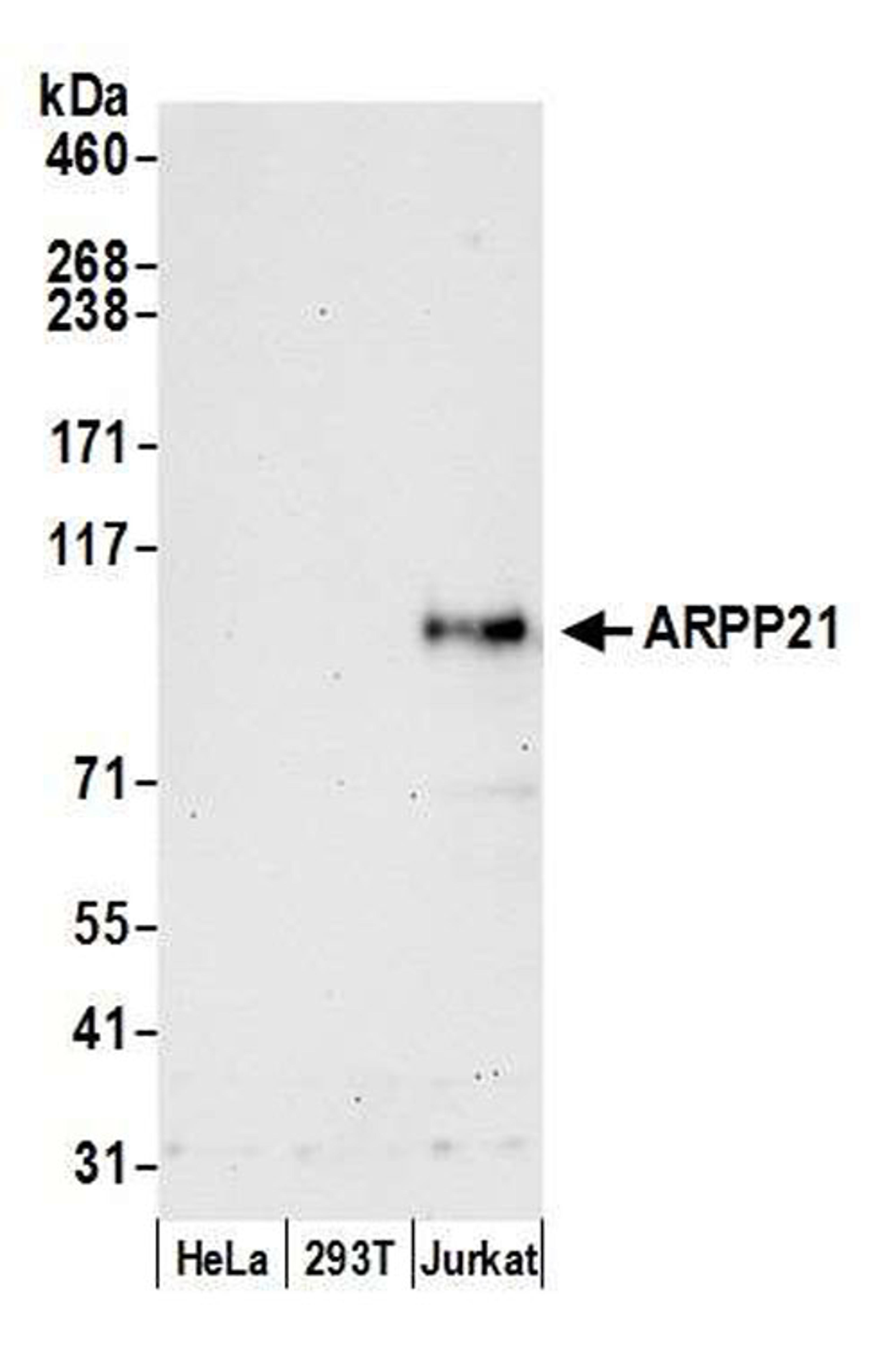 Detection of human ARPP21 by WB.