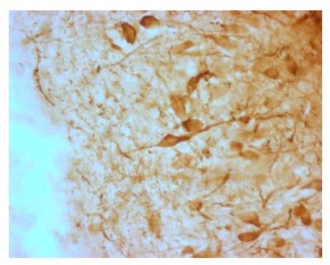 Immunohistochemistry-Frozen: AgRP/ART Antibody [NBP2-36714] - The  4% PFA fixed, frozen cryostat section of the sheep hypothalamus was incubated in guinea pig polyclonal antibodies to the mouse AGRP protein at the dilution of 1:1000 overnight followed by incubation with biotinylated secondary antibodies. Cell bodies and nerve terminals in the sheep brain are intensely stained. This figure shows staining of cells when no pre-absorption is performed.