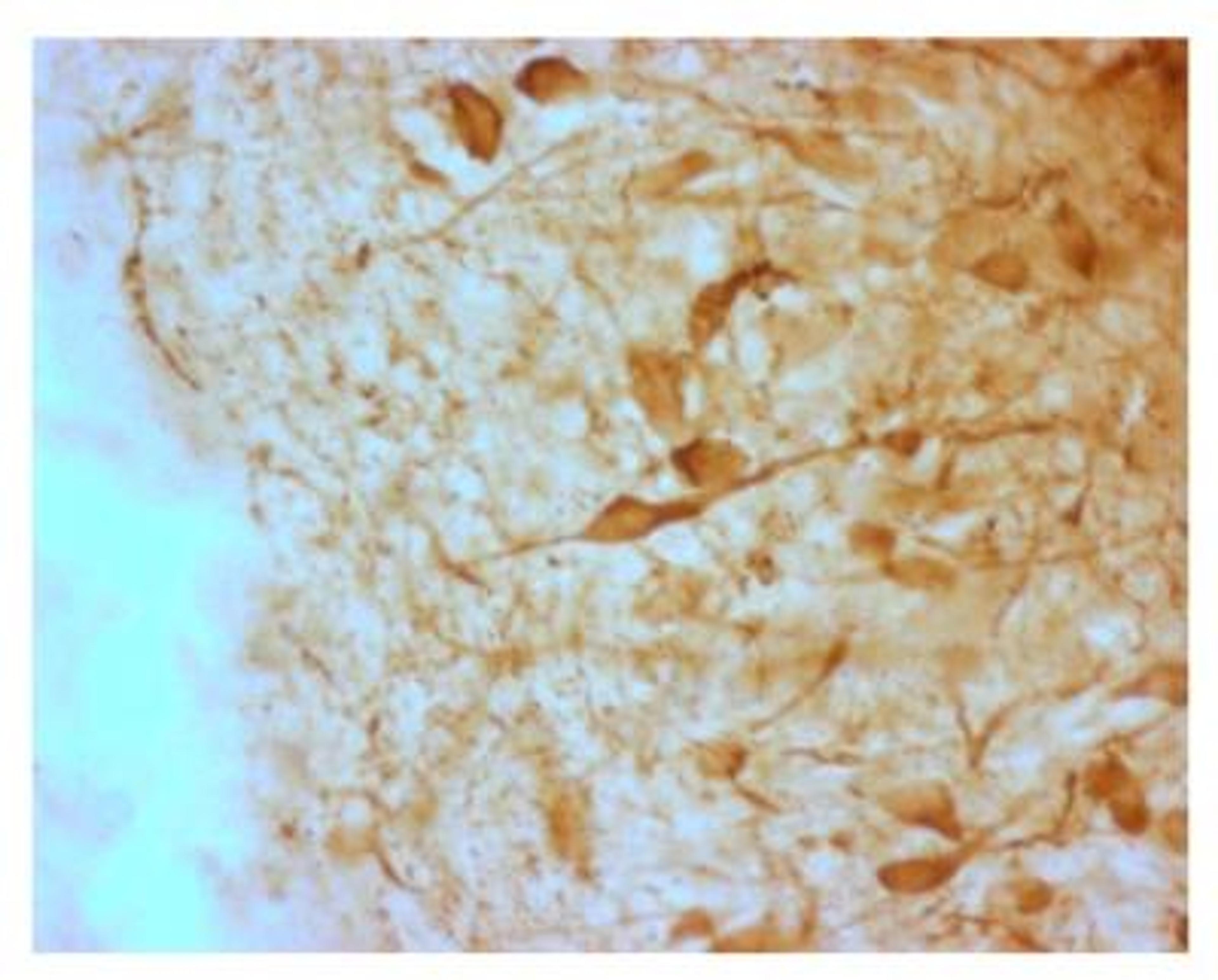 Immunohistochemistry-Frozen: AgRP/ART Antibody [NBP2-36714] - The  4% PFA fixed, frozen cryostat section of the sheep hypothalamus was incubated in guinea pig polyclonal antibodies to the mouse AGRP protein at the dilution of 1:1000 overnight followed by incubation with biotinylated secondary antibodies. Cell bodies and nerve terminals in the sheep brain are intensely stained. This figure shows staining of cells when no pre-absorption is performed.