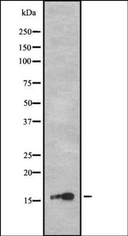 Western blot analysis of HEK293 cells using CA150 antibody