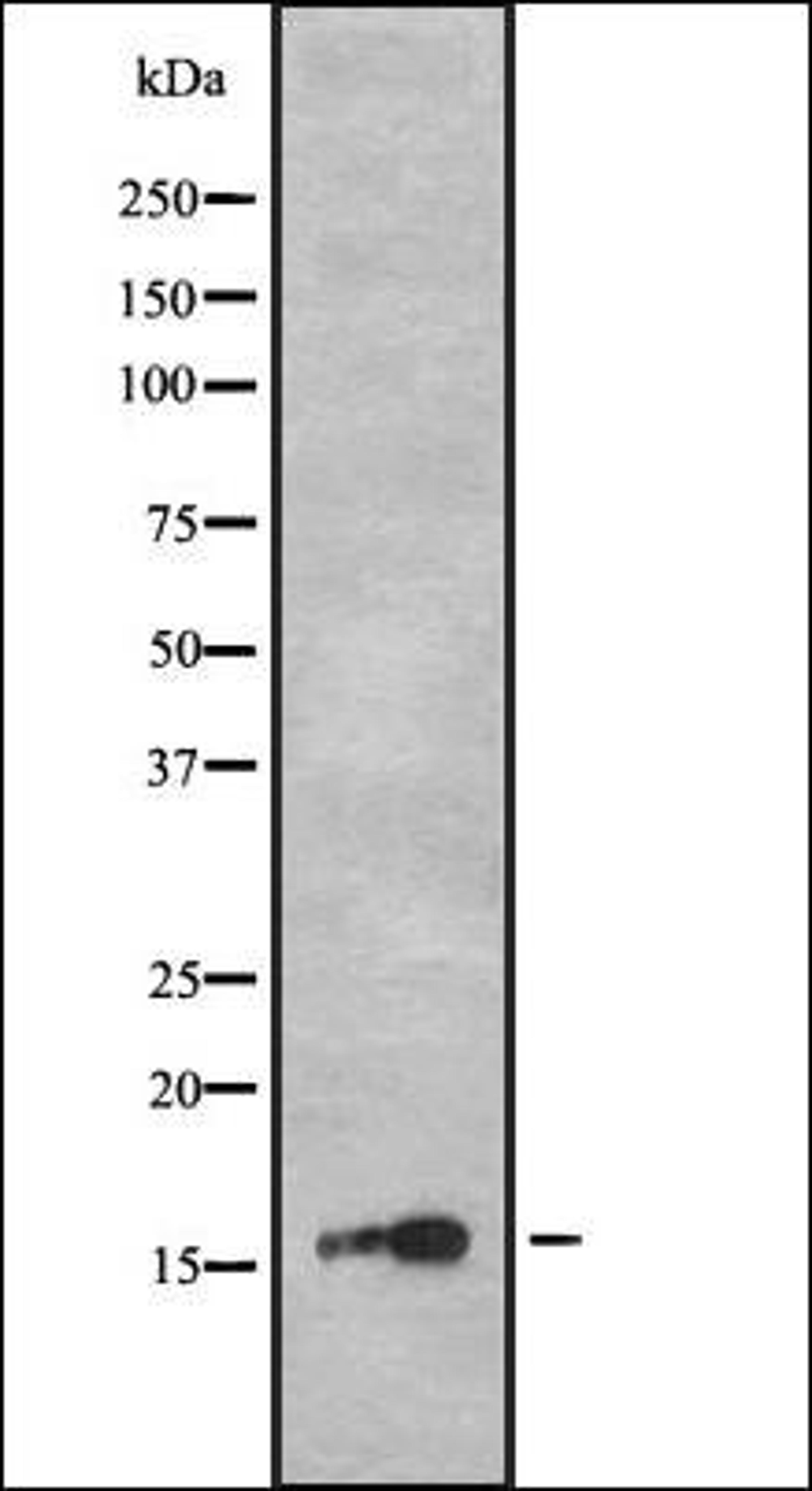 Western blot analysis of HEK293 cells using CA150 antibody