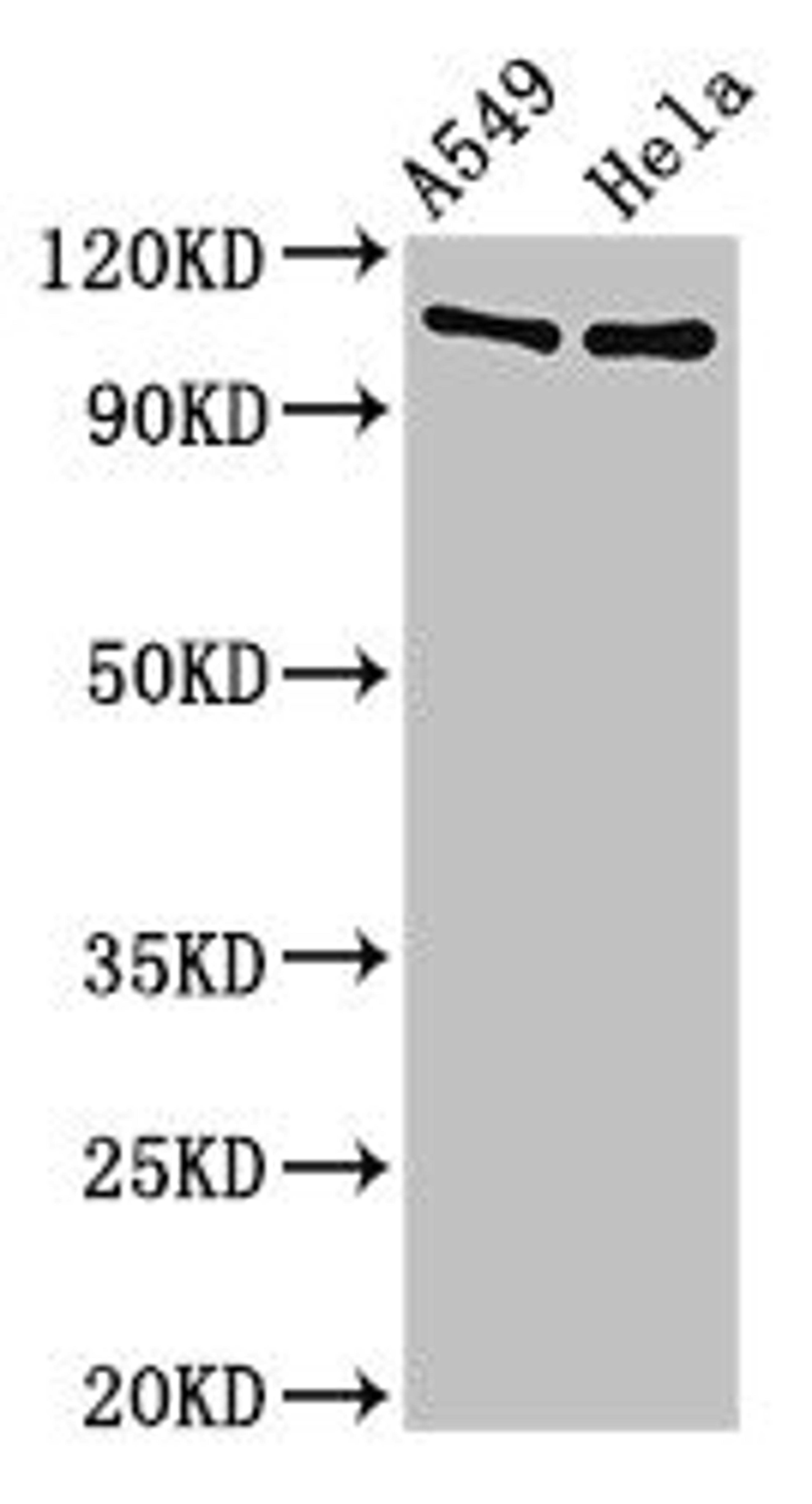 Western Blot. Positive WB detected in: A549 whole cell lysate, Hela whole cell lysate. All lanes: EML4 antibody at 3ug/ml. Secondary. Goat polyclonal to rabbit IgG at 1/50000 dilution. Predicted band size: 109, 103 kDa. Observed band size: 109 kDa.