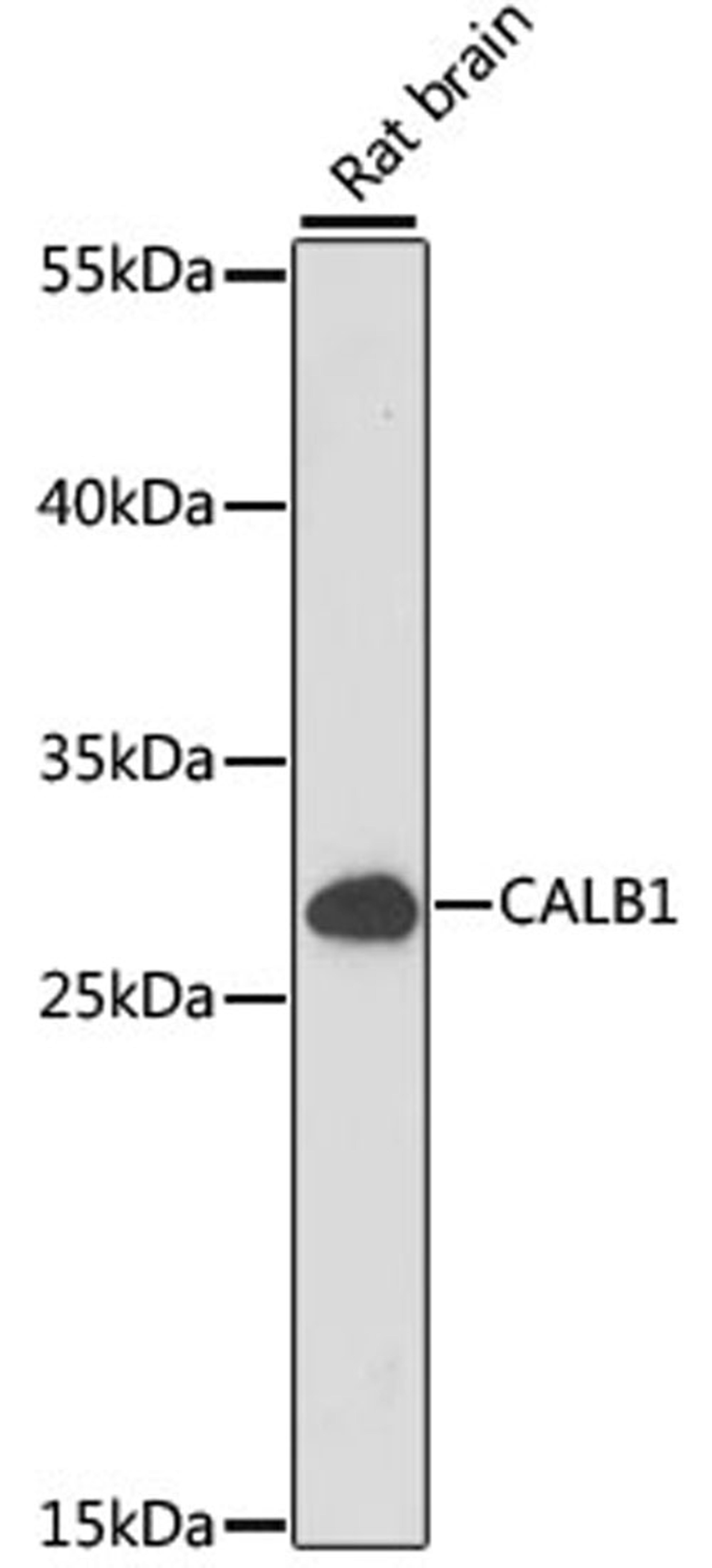 Western blot - CALB1 antibody (A15035)