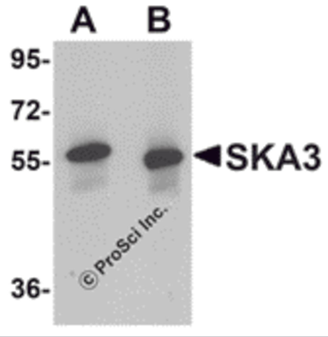 Western blot analysis of SKA3 in human testis tissue lysate with SKA3 antibody at (A) 0.5 and (B) 1 μg/mL.