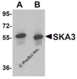Western blot analysis of SKA3 in human testis tissue lysate with SKA3 antibody at (A) 0.5 and (B) 1 μg/mL.