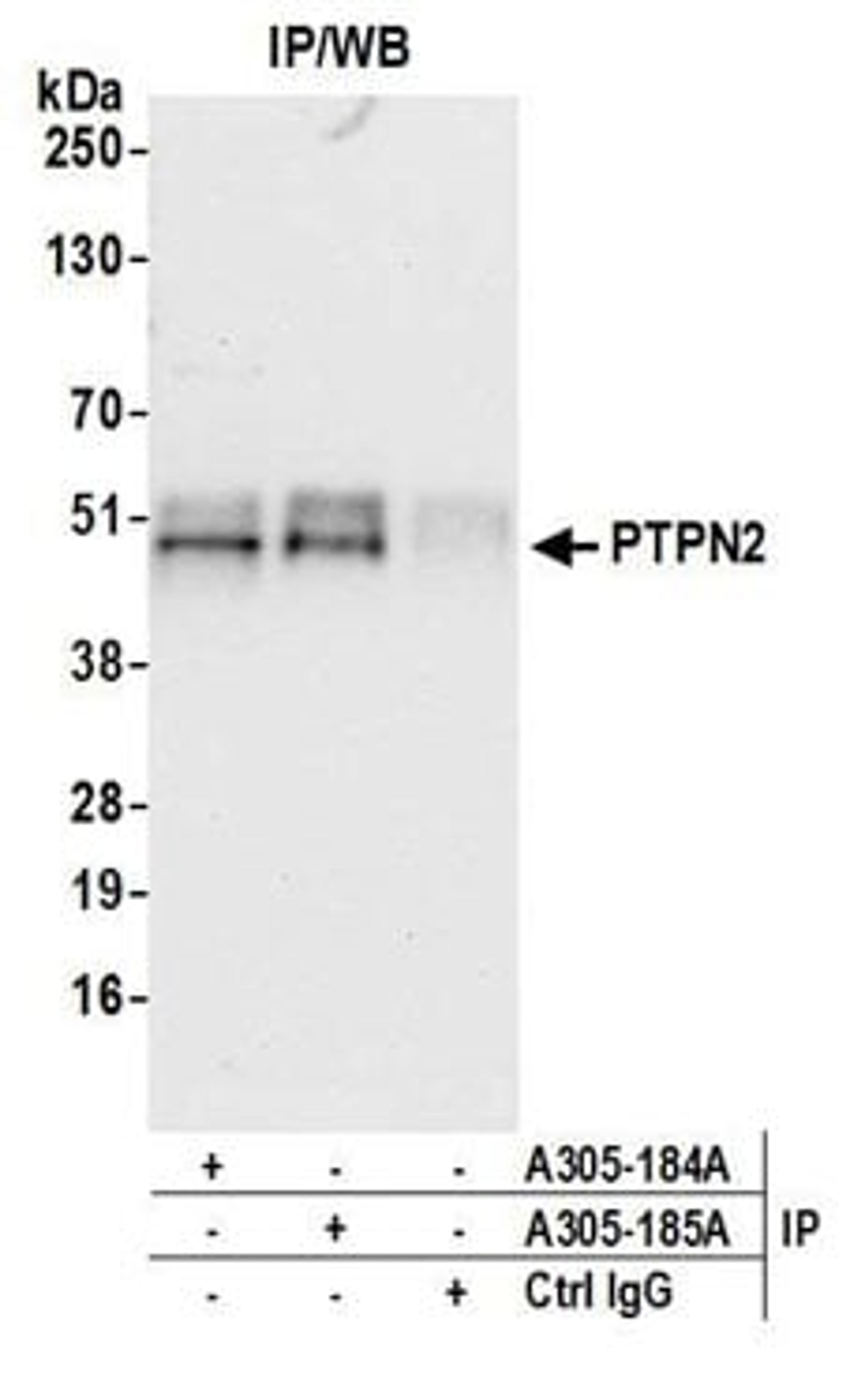 Detection of human PTPN2 by western blot of immunoprecipitates.