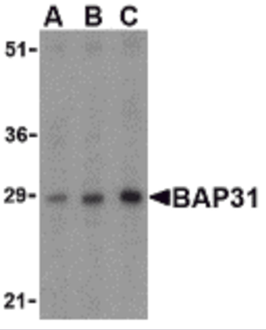 Western blot analysis of BAP31 in rat lung tissue lysate with BAP31 antibody at (A) 0.5, (B) 1 and (C) 2&#956;g/mL.