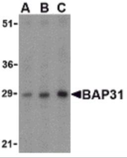 Western blot analysis of BAP31 in rat lung tissue lysate with BAP31 antibody at (A) 0.5, (B) 1 and (C) 2&#956;g/mL.