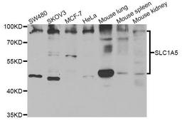 Western blot analysis of extracts of various cell lines using SLC1A5 antibody