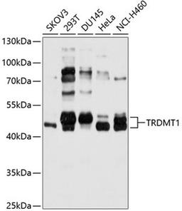 Western blot - TRDMT1 antibody (A10535)