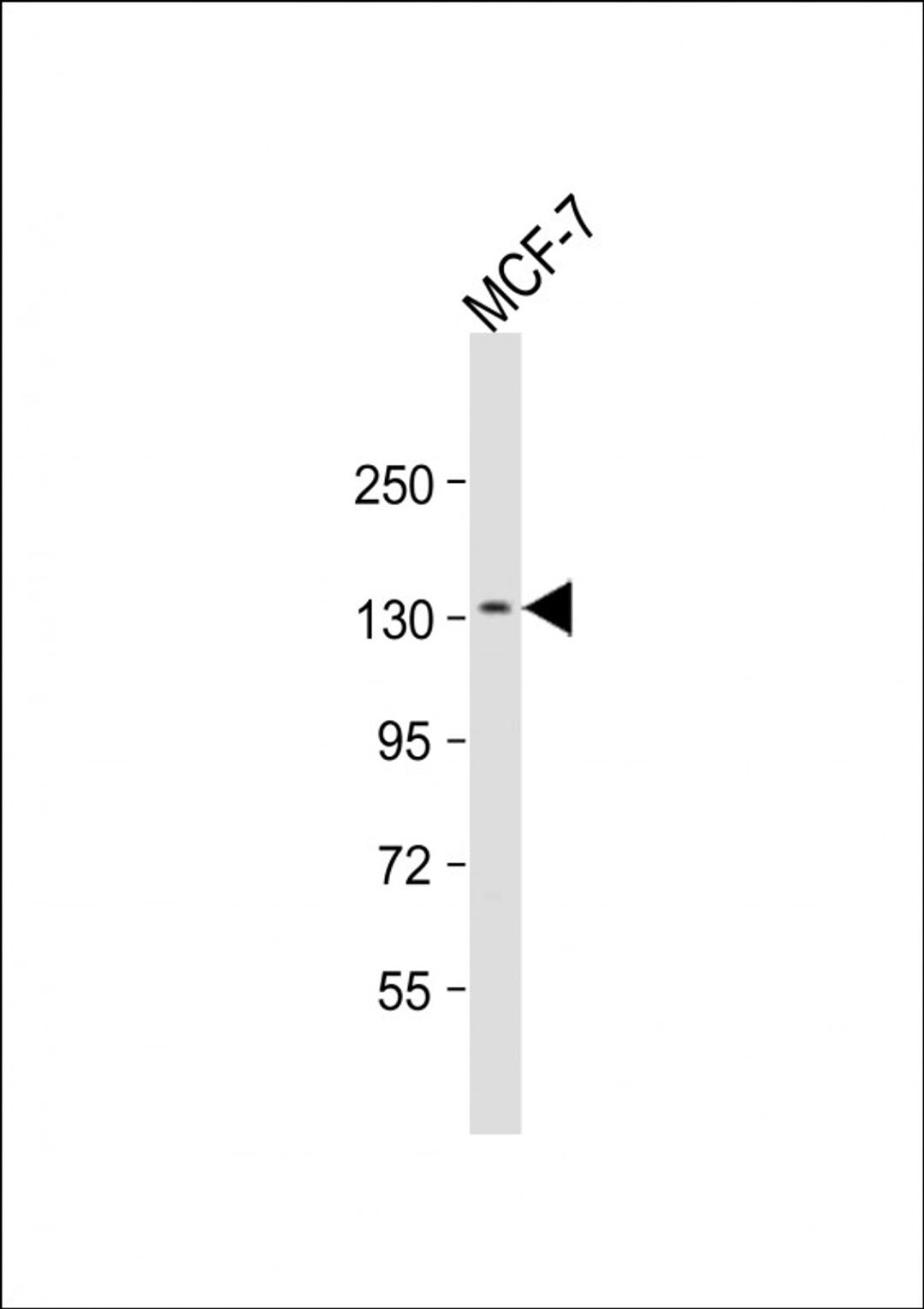 Western Blot at 1:1000 dilution + MCF-7 whole cell lysate Lysates/proteins at 20 ug per lane.