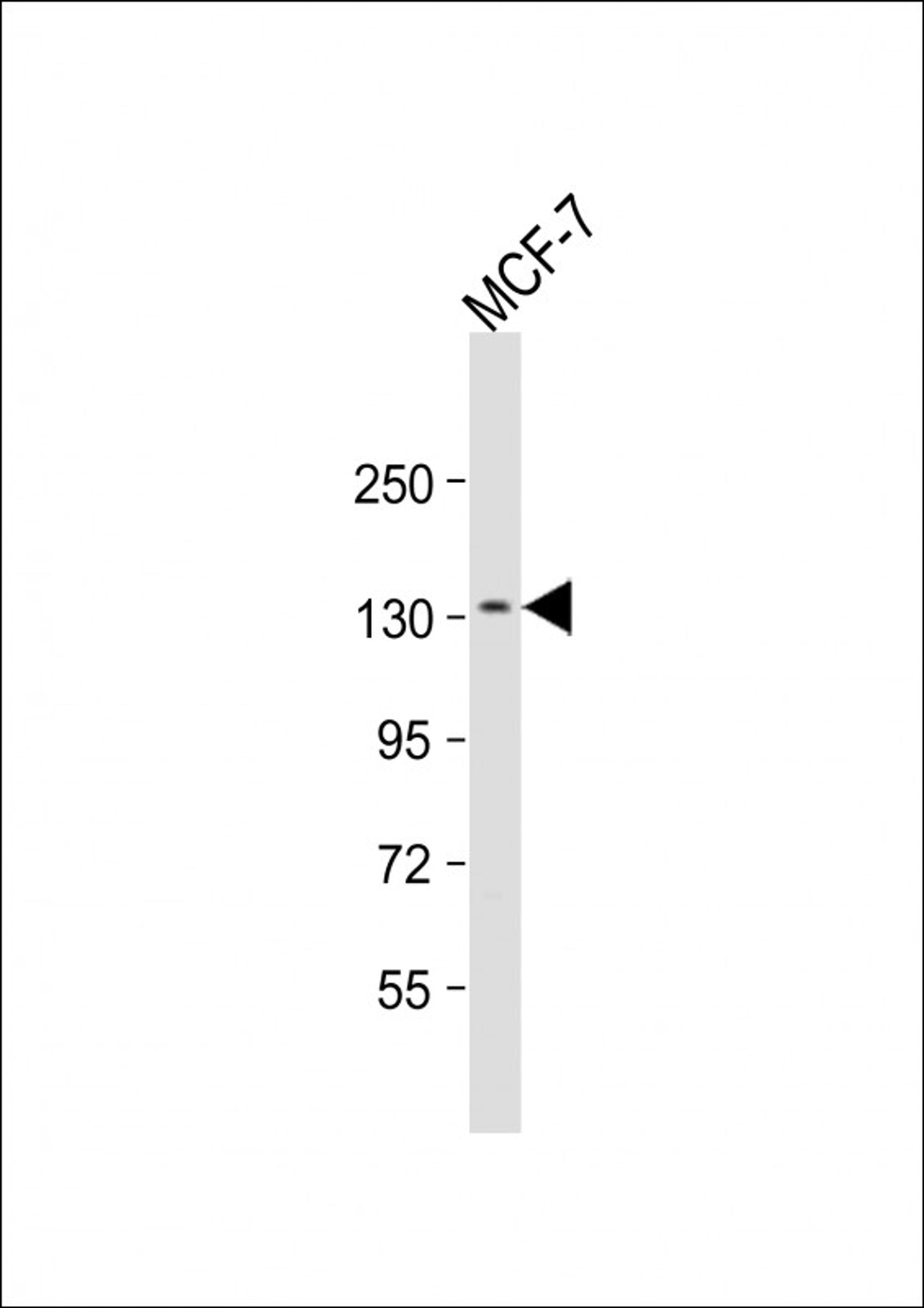 Western Blot at 1:1000 dilution + MCF-7 whole cell lysate Lysates/proteins at 20 ug per lane.