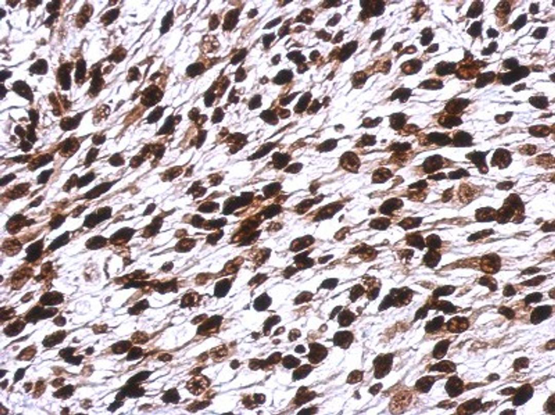 Immunohistochemistry-Paraffin: H1F0 Antibody [NBP2-16772] - Immunohistochemical analysis of paraffin-embedded C2C12 xenograft, using antibody at 1:500 dilution.