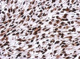 Immunohistochemistry-Paraffin: H1F0 Antibody [NBP2-16772] - Immunohistochemical analysis of paraffin-embedded C2C12 xenograft, using antibody at 1:500 dilution.