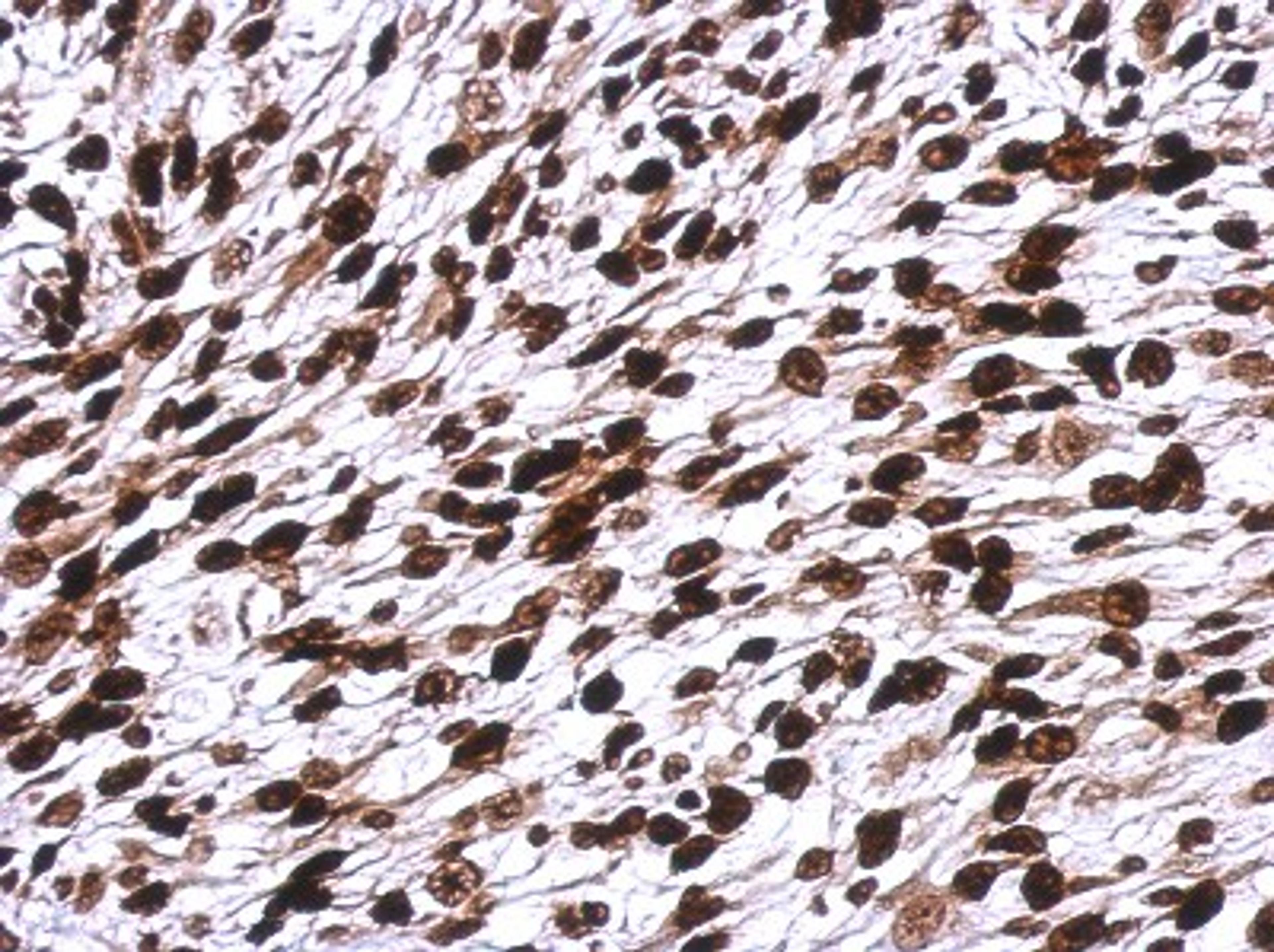 Immunohistochemistry-Paraffin: H1F0 Antibody [NBP2-16772] - Immunohistochemical analysis of paraffin-embedded C2C12 xenograft, using antibody at 1:500 dilution.