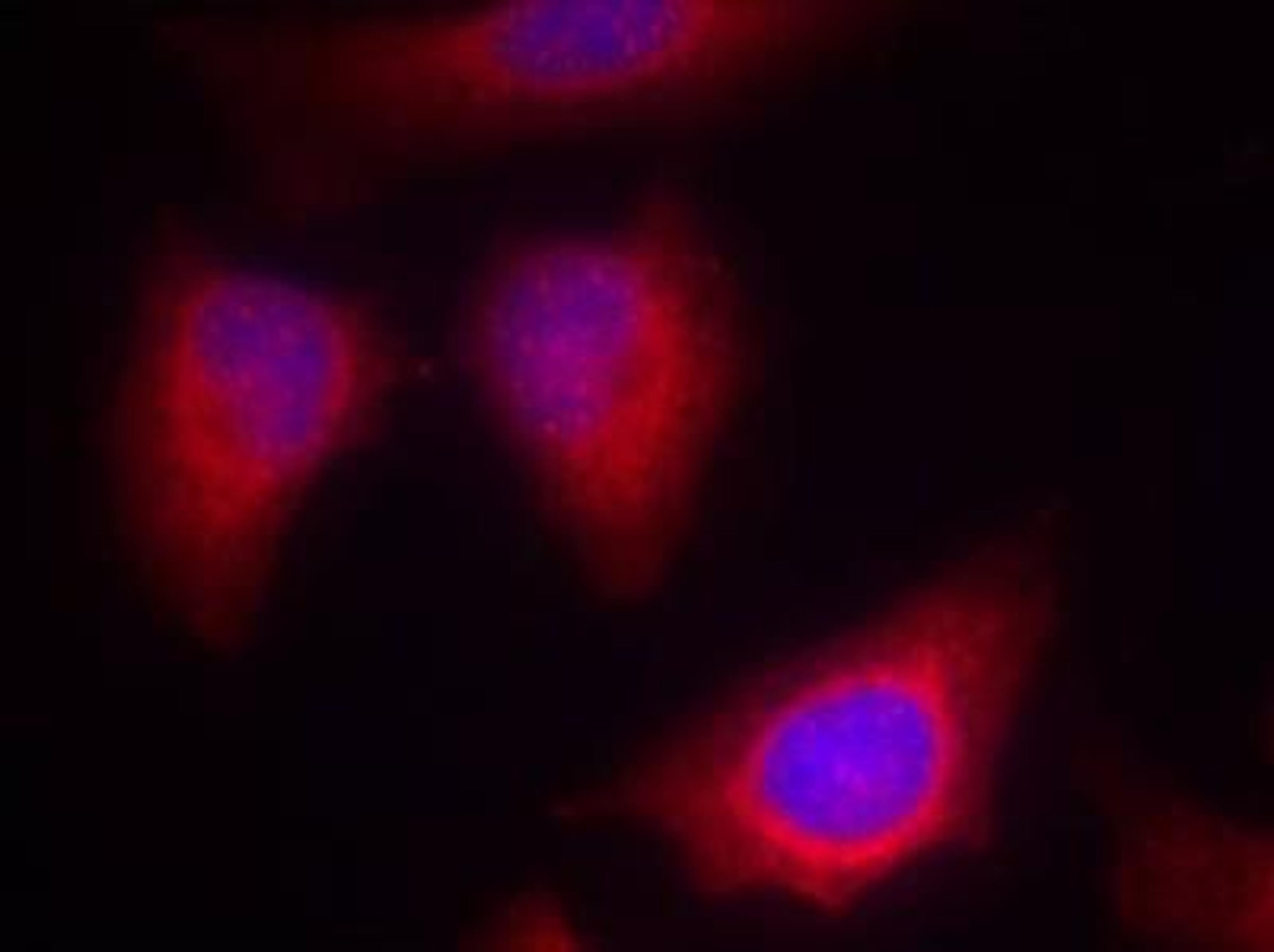 Immunocytochemistry/Immunofluorescence: PKC theta Antibody [NB100-82144] - Methanol-fixed Hela cells using PKC theta antibody