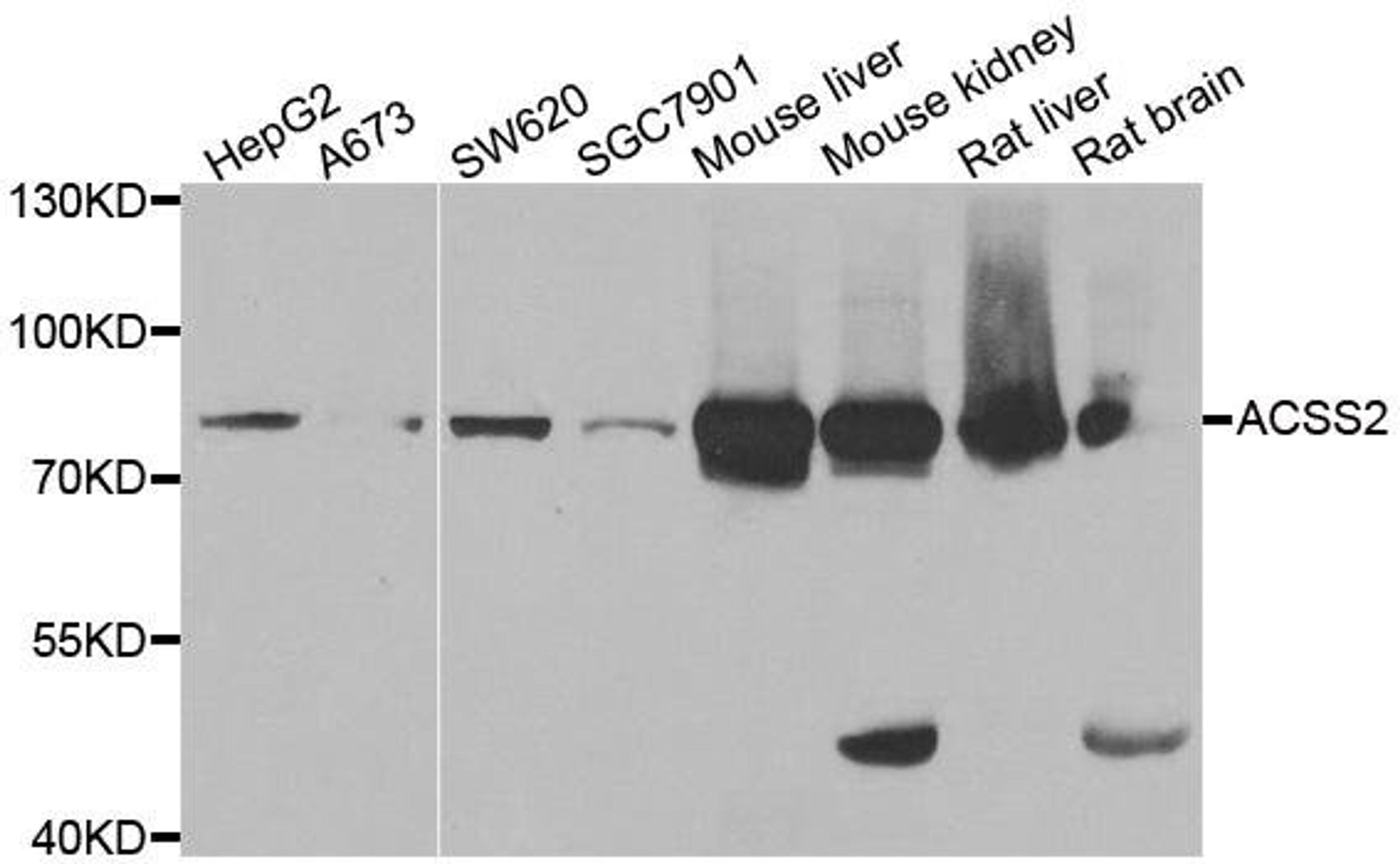 Western blot analysis of extracts of various cell lines using ACSS2 antibody