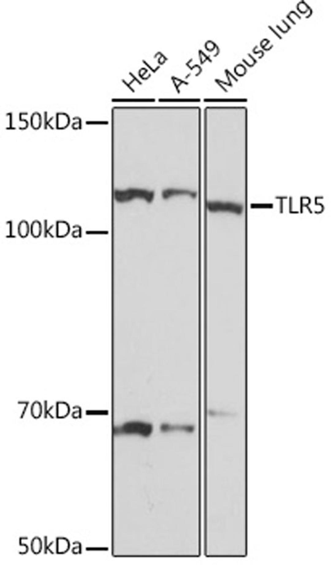 Western blot - TLR5 Rabbit mAb (A8765)