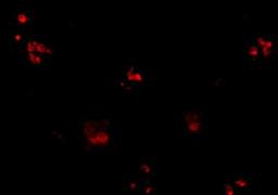 Immunocytochemistry/Immunofluorescence: KCTD15 Antibody [NBP1-77007] - Immunofluorescence of KCTD15 in human spleen tissue with KCTD15 antibody at 20 ug/mL.