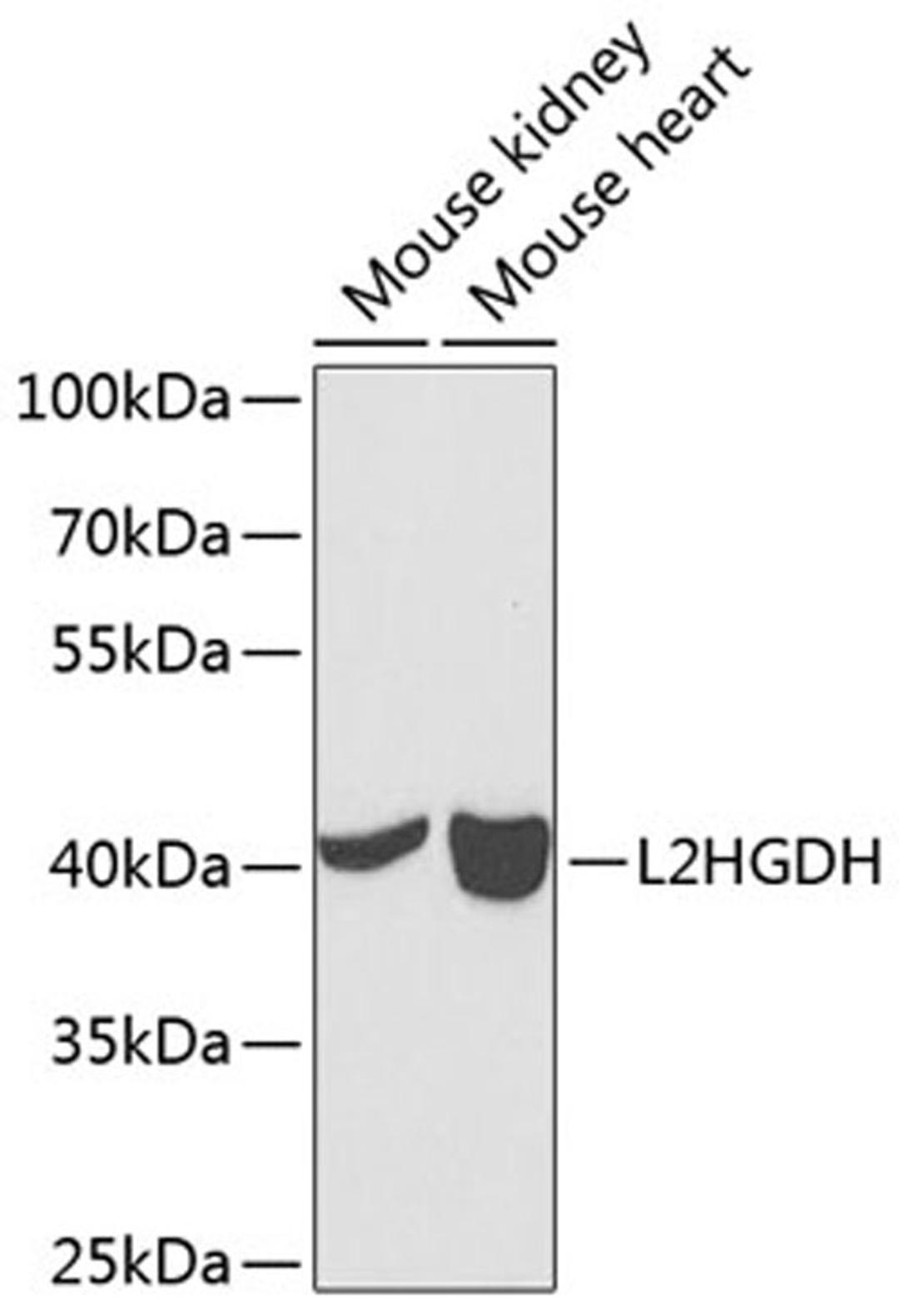 Western blot - L2HGDH antibody (A7996)