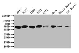 Western Blot. Positive WB detected in: A549 whole cell lysate, MCF7 whole cell lysate, K562 whole cell lysate, 293T whole cell lysate, U251 whole cell lysate, Hela whole cell lysate, Mouse Brain tissue lysate, Rat Brain tissue lysate. All lanes: BTRC antibody at 1:1000. Secondary. Goat polyclonal to rabbit IgG at 1/50000 dilution. Predicted band size: 69 kDa. Observed band size: 69 kDa. 