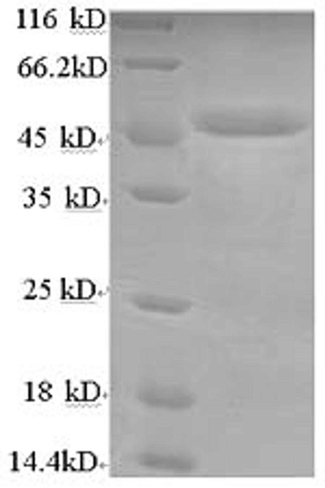 (Tris-Glycine gel) Discontinuous SDS-PAGE (reduced) with 5% enrichment gel and 15% separation gel.