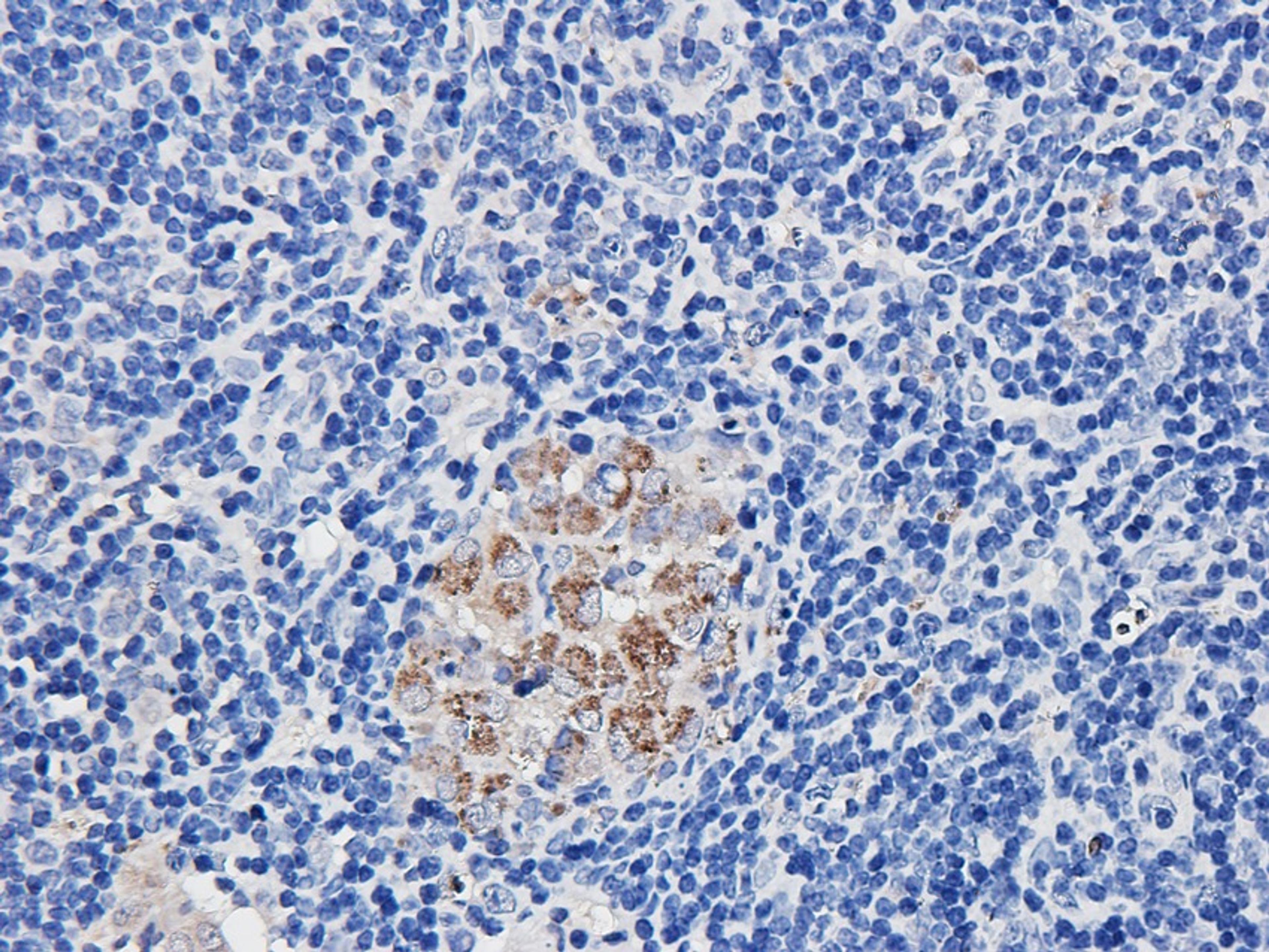 Immunohistochemical staining of paraffin embedded guinea pig lymph node tissue using anti-FCRL4 (2.5 ug/ml)