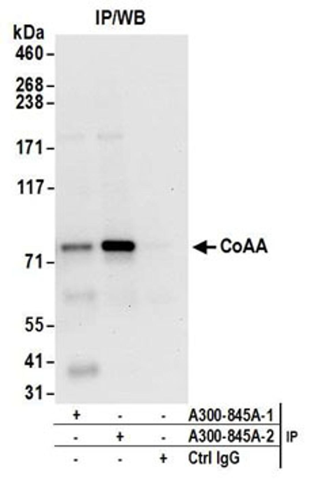 Detection of human CoAA by western blot of immunoprecipitates.