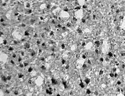 Immunohistochemistry: Factor Inhibiting HIF-1 Antibody [NB100-428] - Detection of FIH-1 in rat brain tissue.