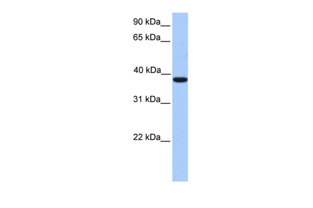 Antibody used in WB on Human Liver at 0.2-1 ug/ml.