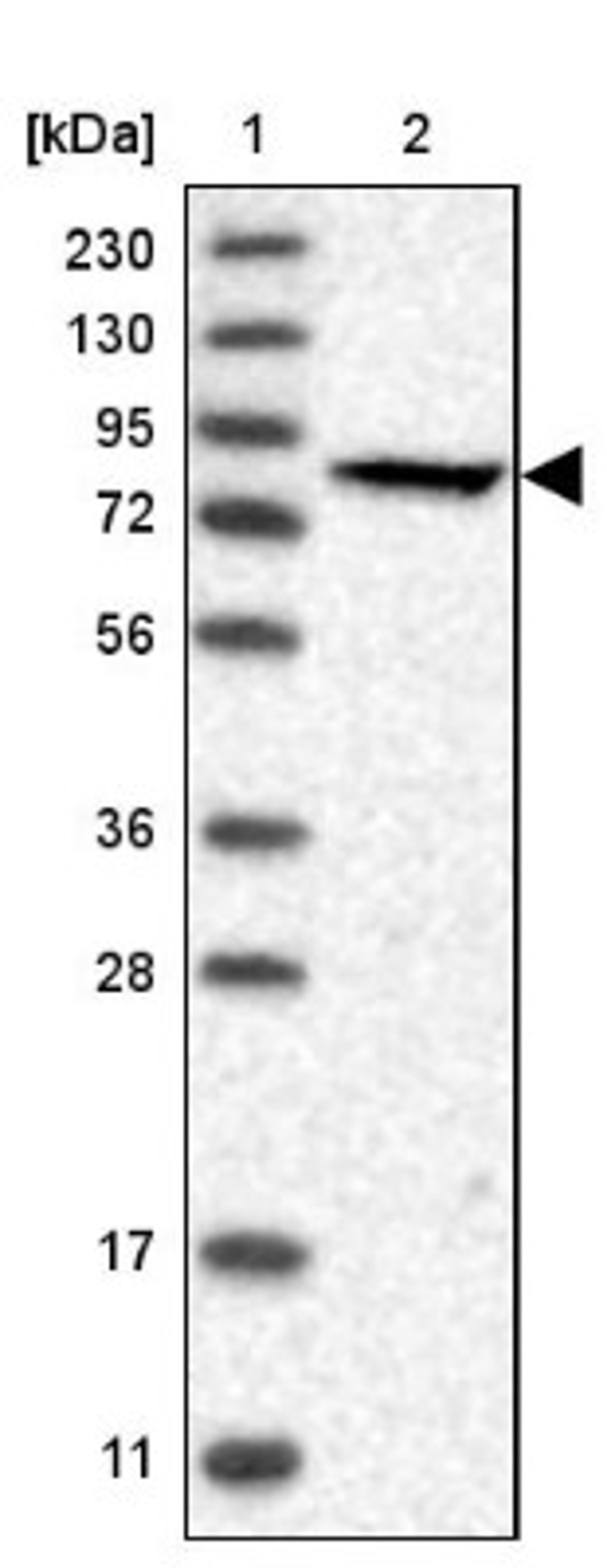 Western Blot: PFKL Antibody [NBP1-85934] - Lane 1: Marker [kDa] 230, 130, 95, 72, 56, 36, 28, 17, 11<br/>Lane 2: Human cell line RT-4