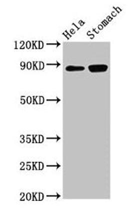 Western Blot. Positive WB detected in: Hela whole cell lysate, Rat stomach tissue. All lanes: ASAH2 antibody at 3µg/ml. Secondary. Goat polyclonal to rabbit IgG at 1/50000 dilution. Predicted band size: 86, 82 kDa. Observed band size: 86 kDa