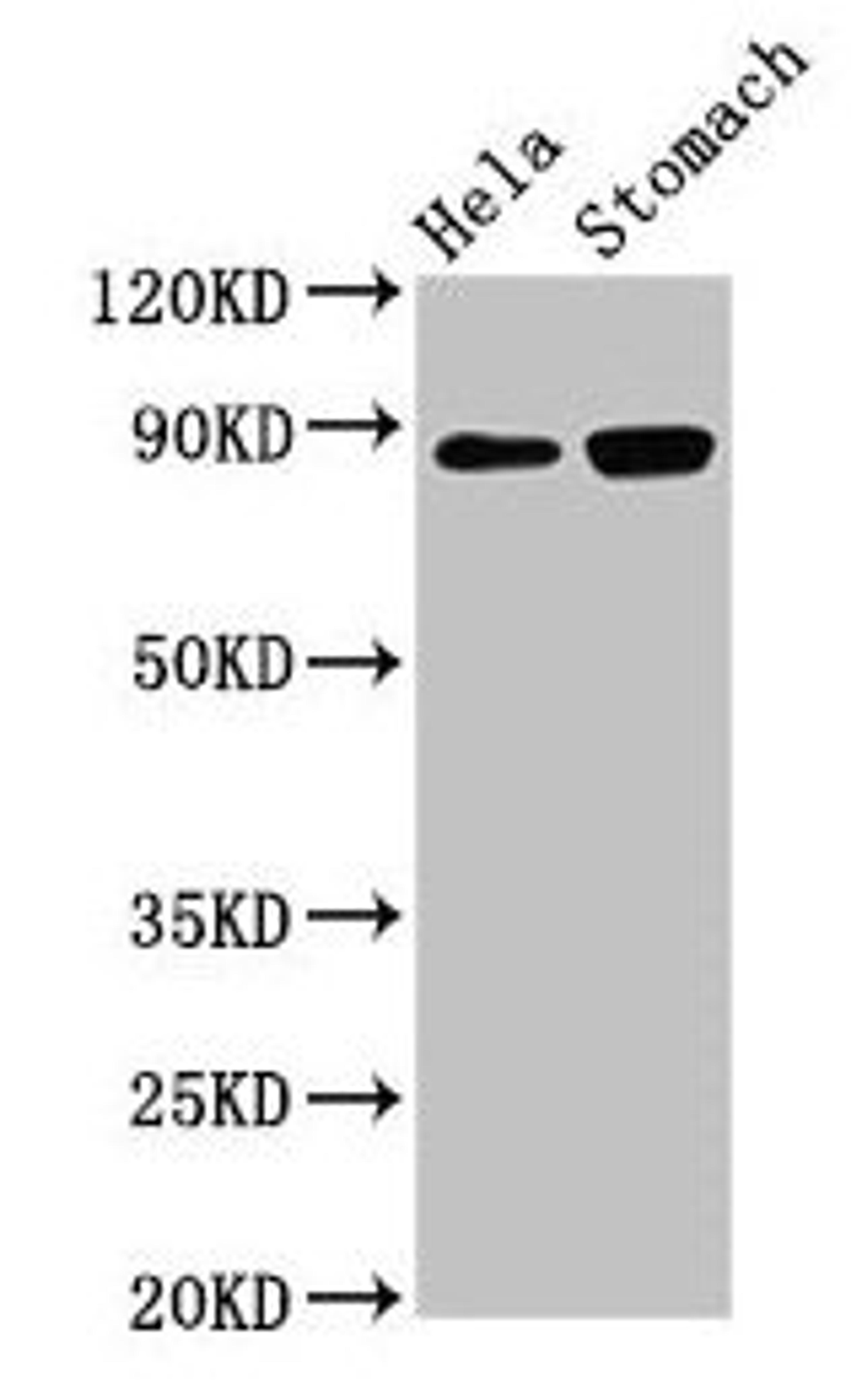 Western Blot. Positive WB detected in: Hela whole cell lysate, Rat stomach tissue. All lanes: ASAH2 antibody at 3µg/ml. Secondary. Goat polyclonal to rabbit IgG at 1/50000 dilution. Predicted band size: 86, 82 kDa. Observed band size: 86 kDa