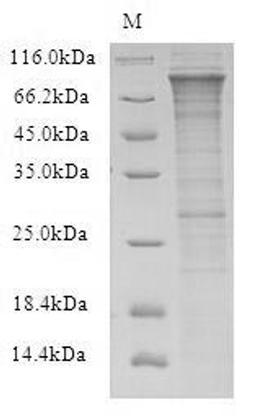 (Tris-Glycine gel) Discontinuous SDS-PAGE (reduced) with 5% enrichment gel and 15% separation gel.