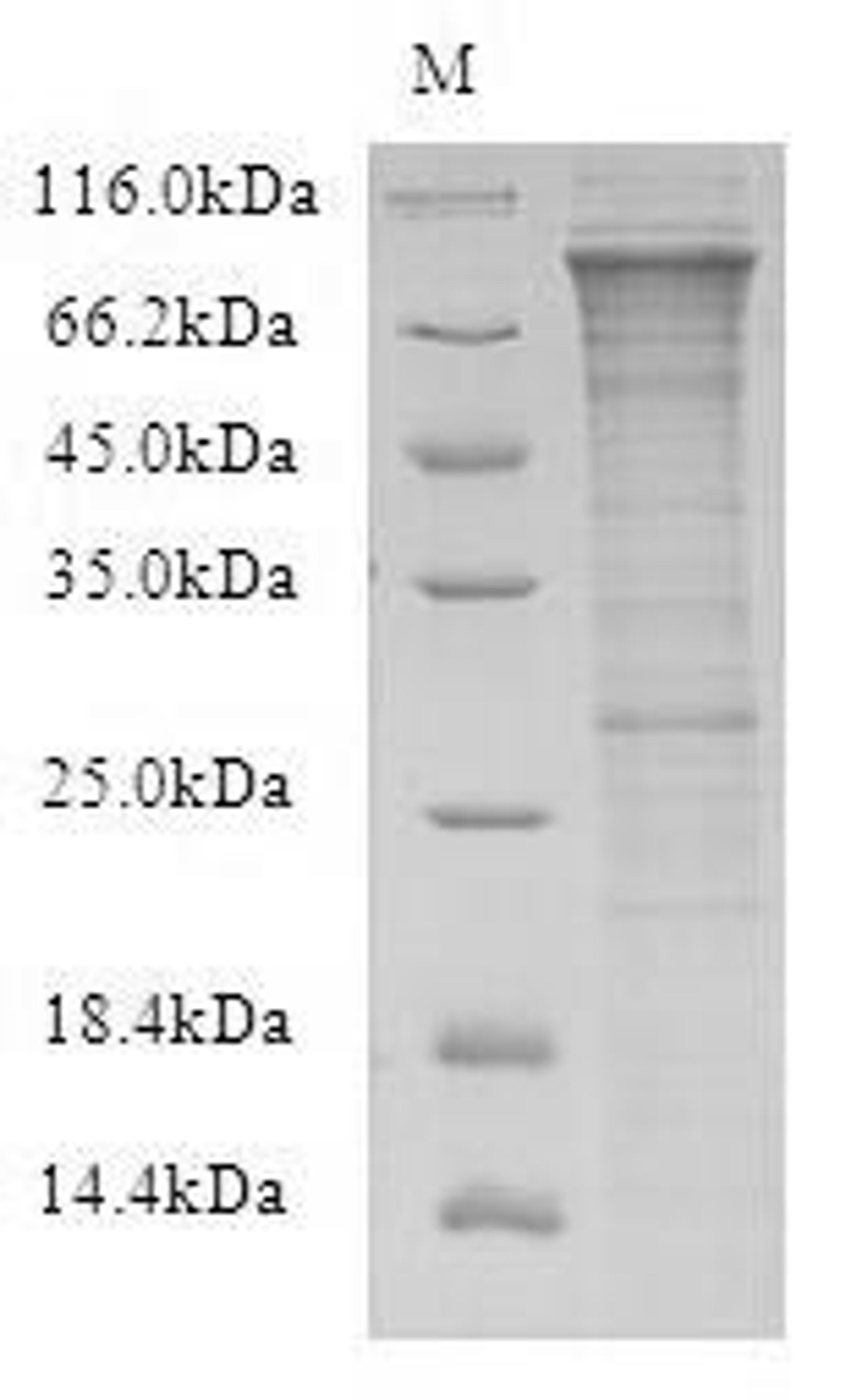 (Tris-Glycine gel) Discontinuous SDS-PAGE (reduced) with 5% enrichment gel and 15% separation gel.