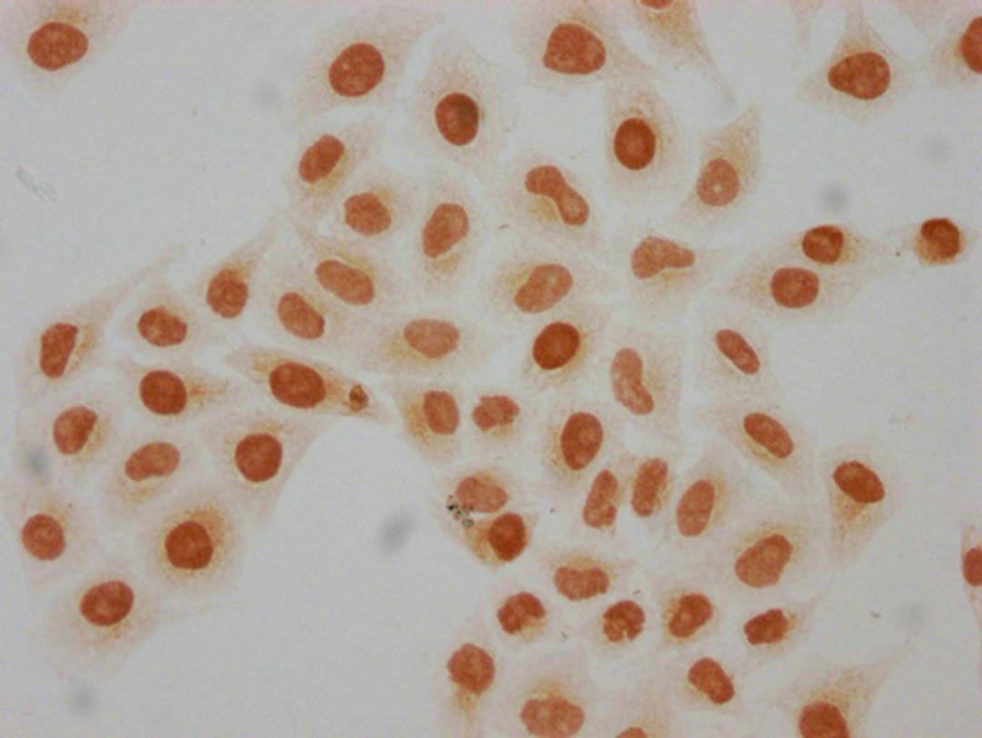 Immunocytochemistry analysis of CSB-PA010429PA08hibHU diluted at 1:50 and staining in Hela cells(treated with 30mM sodium butyrate for 4h) performed on a Leica BondTM system. The cells were fixed in 4% formaldehyde, permeabilized using 0.2% Triton X-100 and blocked with 10% normal goat serum 30min at RT. Then primary antibody (1% BSA) was incubated at 4°C overnight. The primary is detected by a biotinylated secondary antibody and visualized using an HRP conjugated SP system.