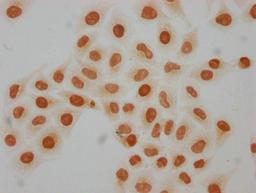 Immunocytochemistry analysis of CSB-PA010429PA08hibHU diluted at 1:50 and staining in Hela cells(treated with 30mM sodium butyrate for 4h) performed on a Leica BondTM system. The cells were fixed in 4% formaldehyde, permeabilized using 0.2% Triton X-100 and blocked with 10% normal goat serum 30min at RT. Then primary antibody (1% BSA) was incubated at 4°C overnight. The primary is detected by a biotinylated secondary antibody and visualized using an HRP conjugated SP system.