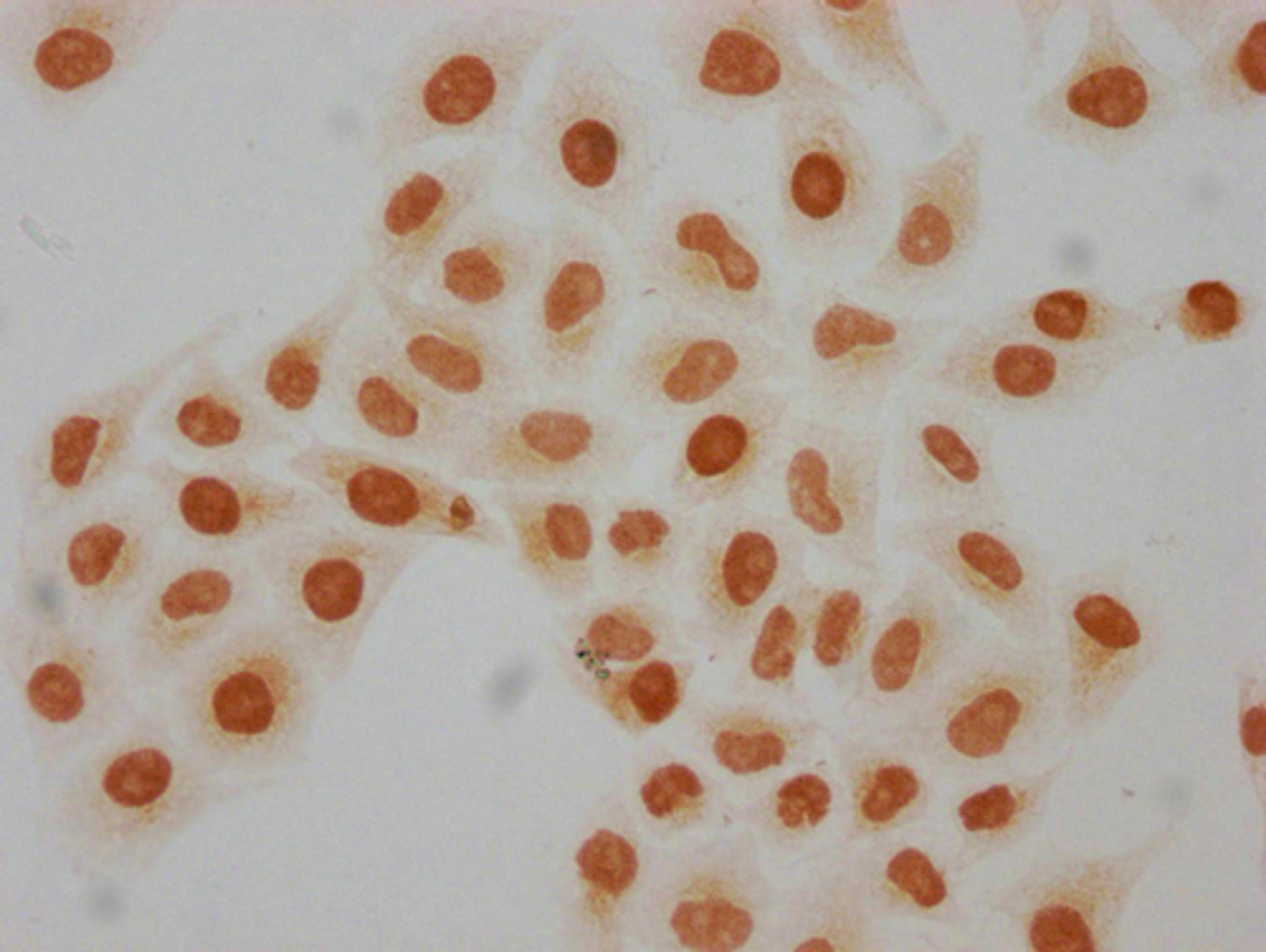 Immunocytochemistry analysis of CSB-PA010429PA08hibHU diluted at 1:50 and staining in Hela cells(treated with 30mM sodium butyrate for 4h) performed on a Leica BondTM system. The cells were fixed in 4% formaldehyde, permeabilized using 0.2% Triton X-100 and blocked with 10% normal goat serum 30min at RT. Then primary antibody (1% BSA) was incubated at 4°C overnight. The primary is detected by a biotinylated secondary antibody and visualized using an HRP conjugated SP system.