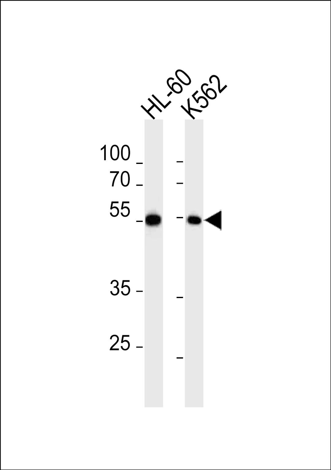 Western blot analysis in HL-60,K562 cell line lysates (35ug/lane).