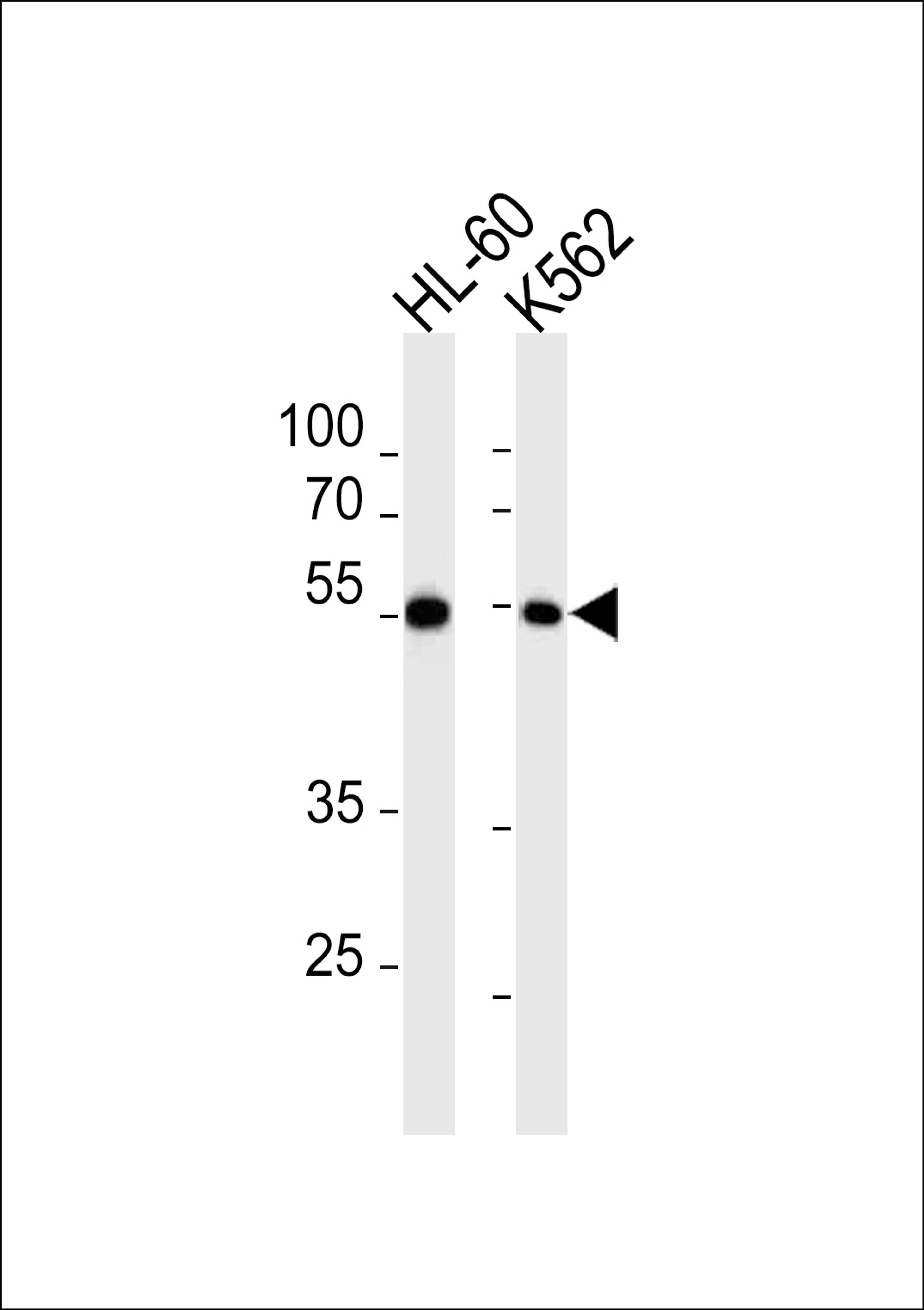 Western blot analysis in HL-60,K562 cell line lysates (35ug/lane).