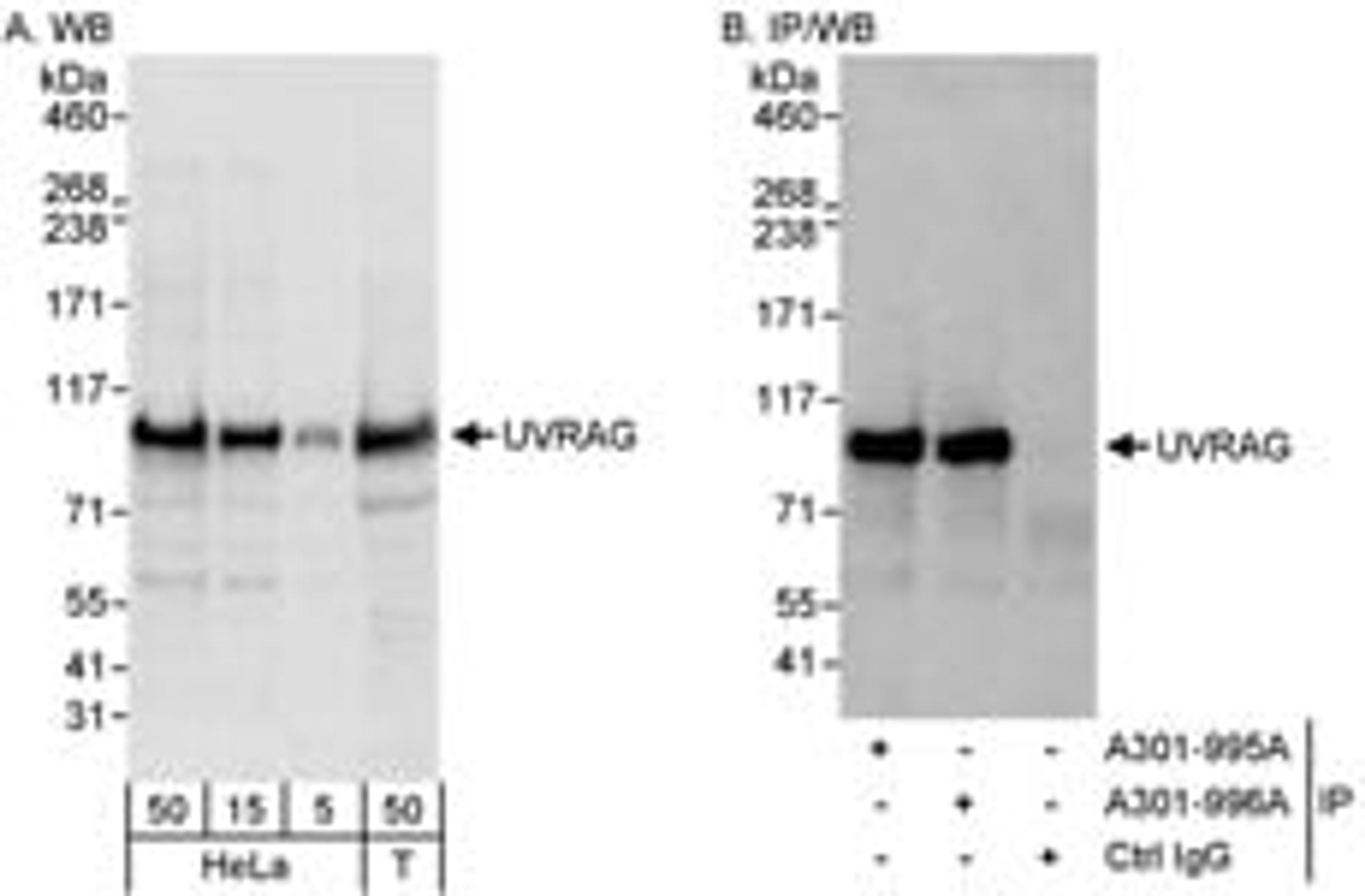 Detection of human UVRAG by western blot and immunoprecipitation.