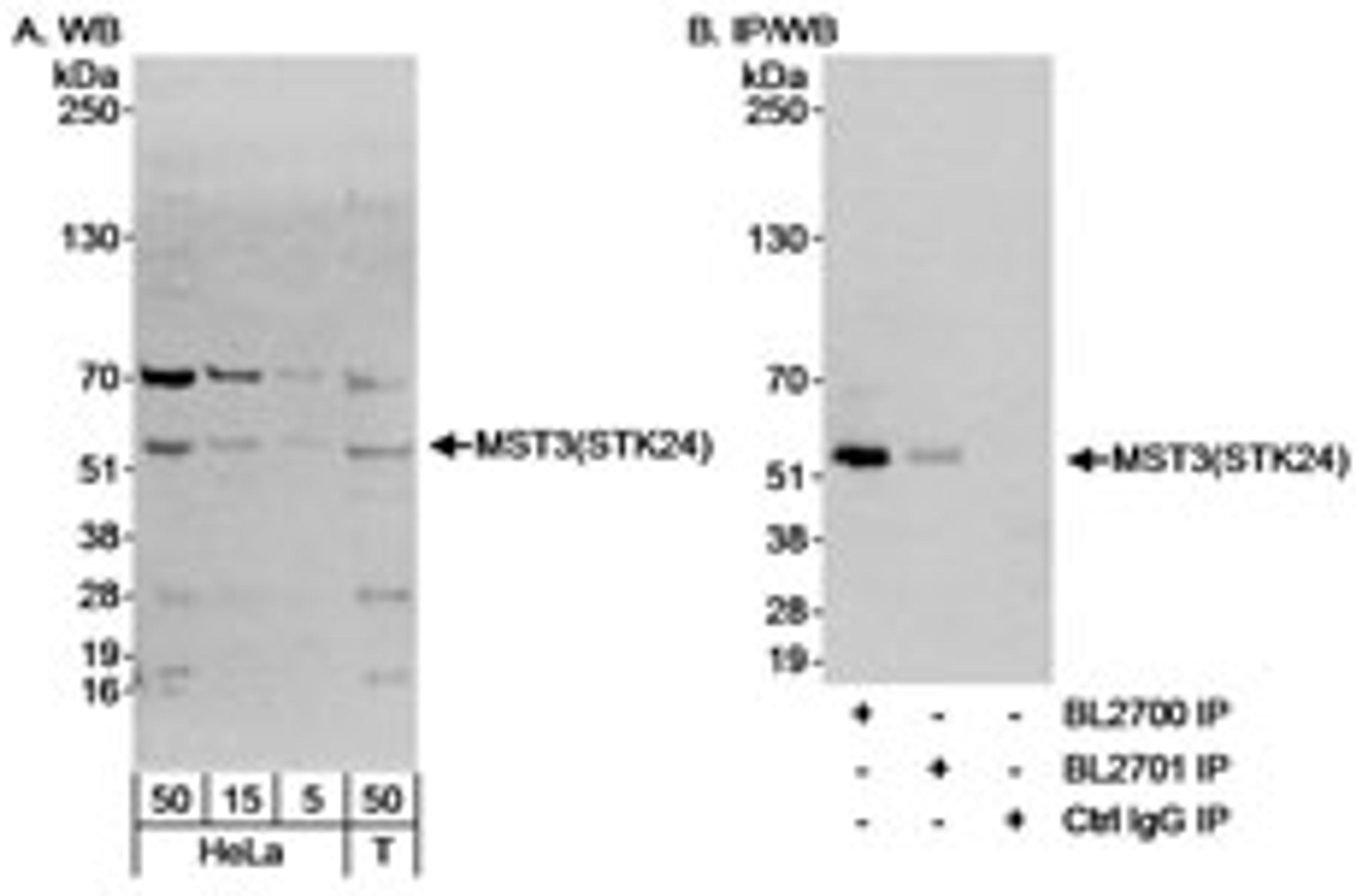 Detection of human MST3(STK24) by western blot and immunoprecipitation.