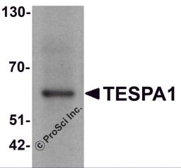 Western blot analysis of TESPA1 in A431 cell lysate with TESPA1 antibody at 1 μg/ml.