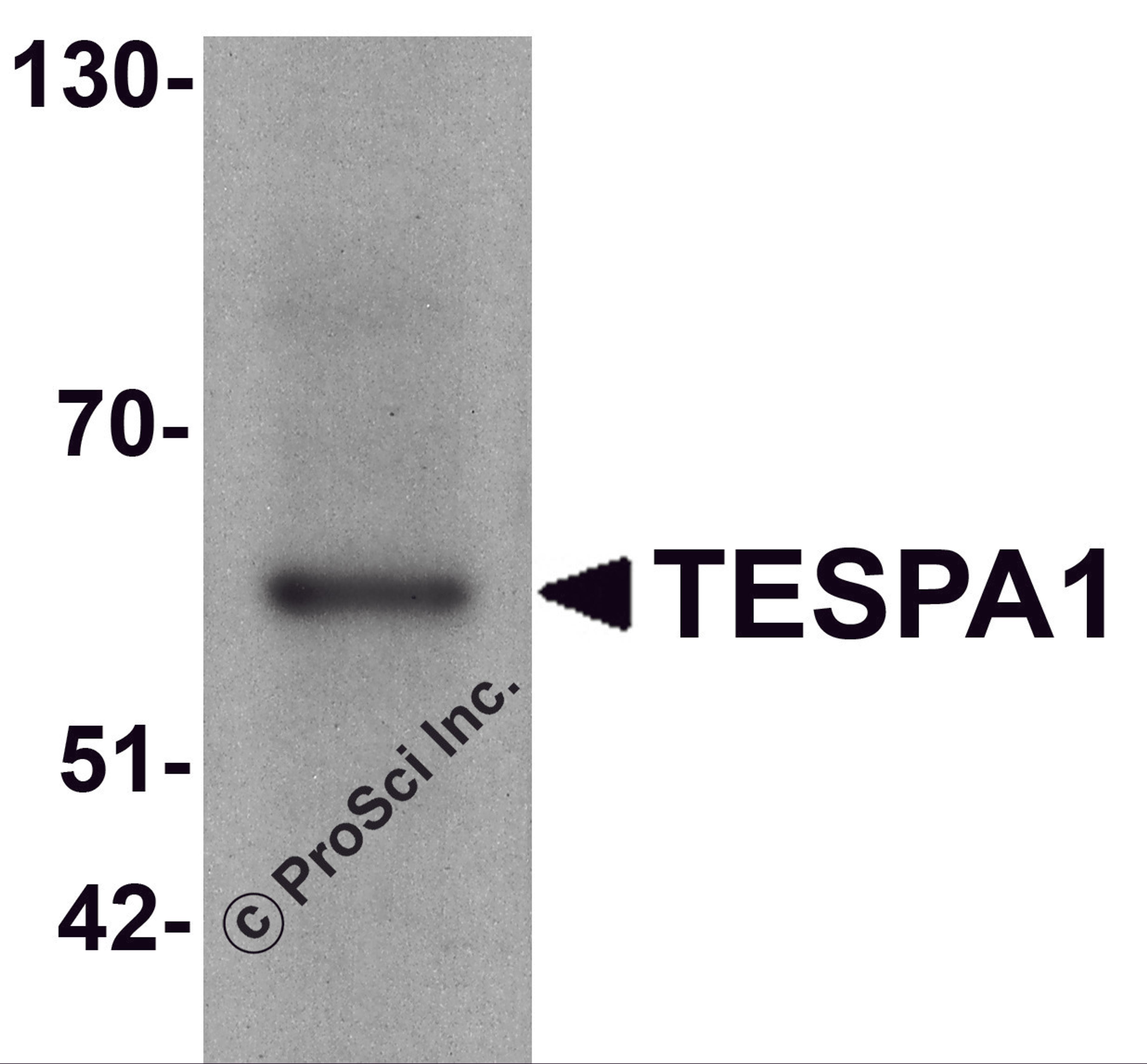 Western blot analysis of TESPA1 in A431 cell lysate with TESPA1 antibody at 1 μg/ml.