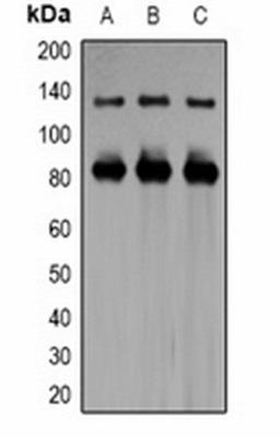 Western blot analysis of  HeLa (Lane1), mouse brain (Lane2), rat brain (Lane3) whole cell lysates using Kv11.3 antibody