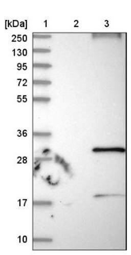 Western Blot: RNF182 Antibody [NBP1-82707] - Lane 1: Marker [kDa] 250, 130, 95, 72, 55, 36, 28, 17, 10<br/>Lane 2: Negative control (vector only transfected HEK293T lysate)<br/>Lane 3: Over-expression lysate (Co-expressed with a C-terminal myc-DDK tag (~3.1 kDa) in mammalian HEK293T cells, LY403489)