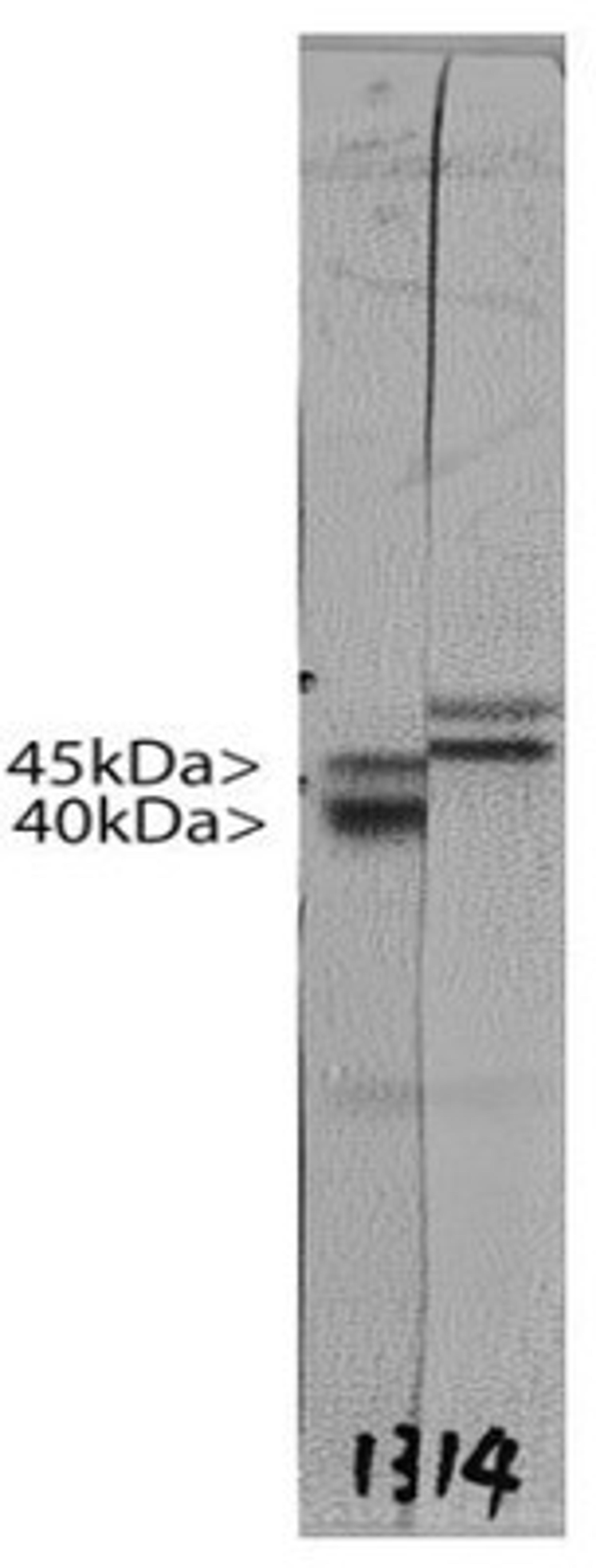 Western Blot: Doublecortin Antibody (3E1) [NBP1-92684] - Western blot of crude rat brain extract from a postnatal 3 day animal stained with NBP1-92684. Two bands at ~45kDa and ~35kDa show that NBP1-92684 binds to an epitope in the region of Doublecortin shared by Lis-A, and Lis-B, Lis-C and Lis-D, the C terminal 360 amino acids of Lis-A.